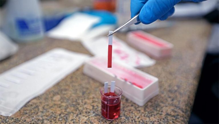 Vereador propõe teste mais moderno para identificar HPV precocemente em Manaus