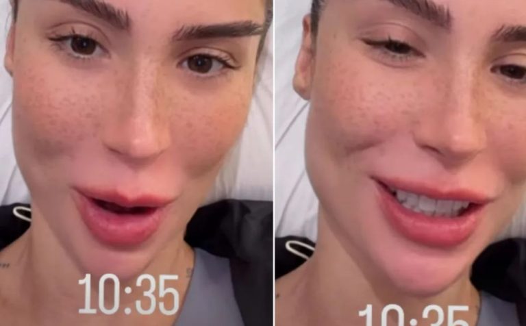 Bianca Andrade explica crescimento dos fios após transplante de sobrancelha