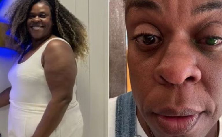 Cacau Protásio volta a enxergar após cegueira temporária