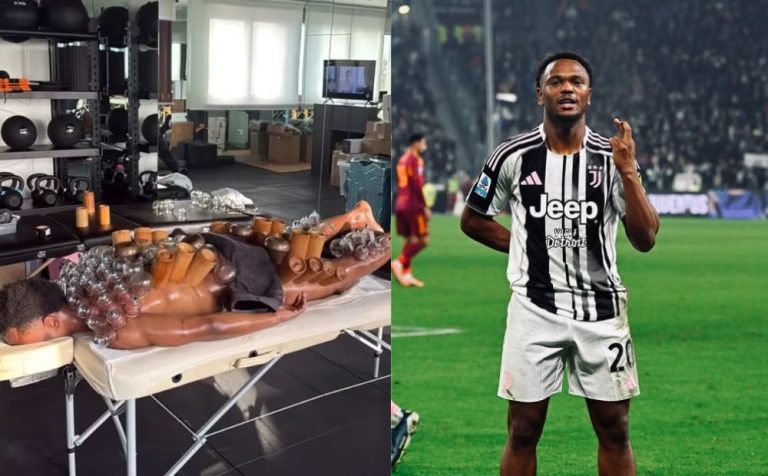 Atacante da Juventus chama atenção pelo excesso de ventosas em tratamento